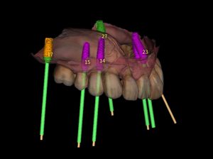 CBCT צילום סביון מדיקל סנטר