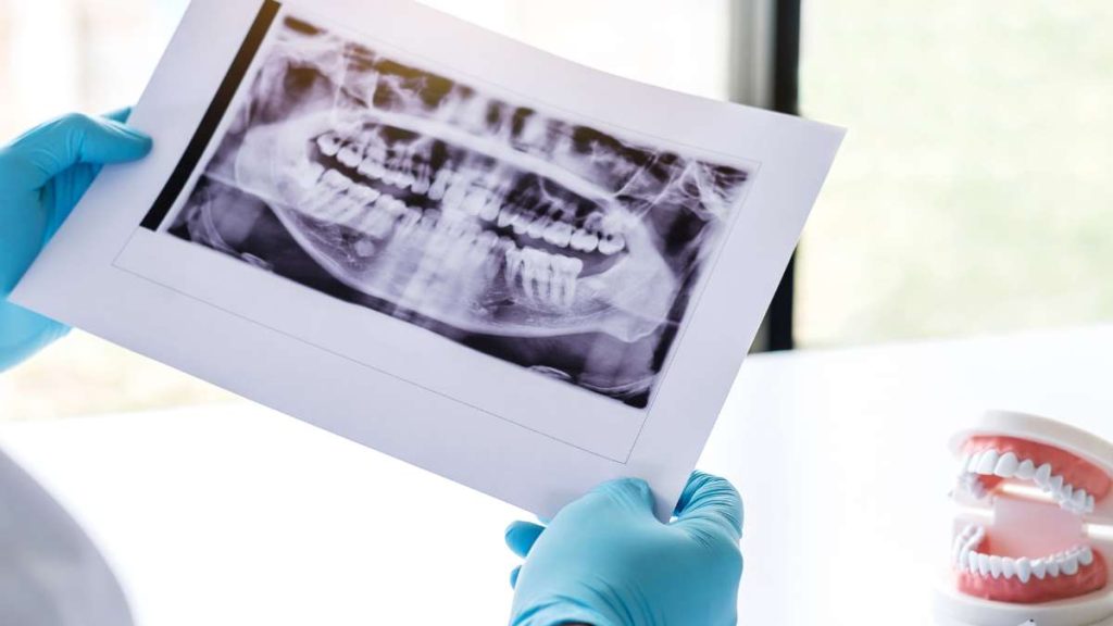 צילום CBCT – קדמת הטכנולוגיה ברפואת שיניים סביון מדיקל סנטר