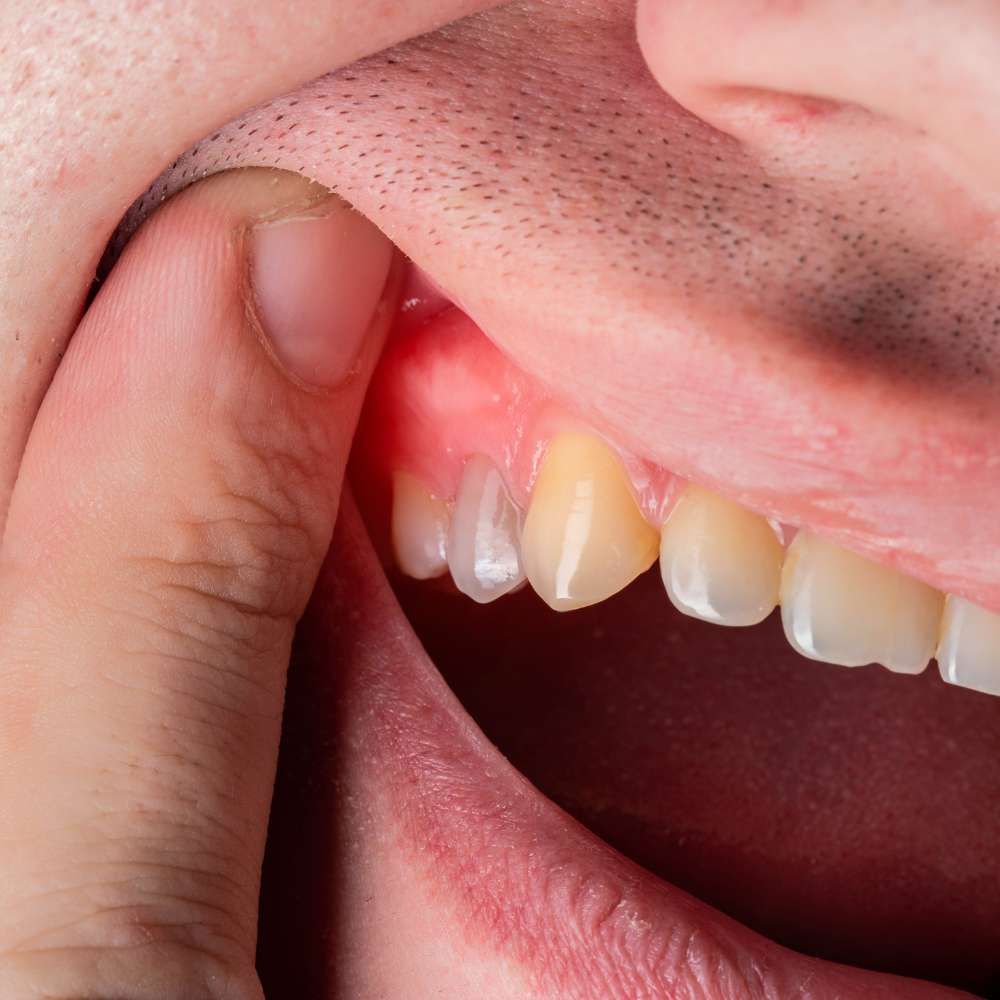 Recurrent infections and inflammations דר אריאל סביון